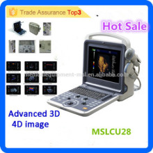 2016 Neueste Marke MSLCU28I 3d / 4d Laptop / portable Farbe Doppler Ultraschall / Farbe Doppler Ultraschall Ausrüstung Preis